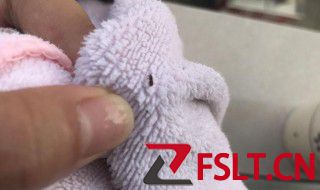 虱子和跳蚤区别有哪些 虱子和跳蚤有什么不同